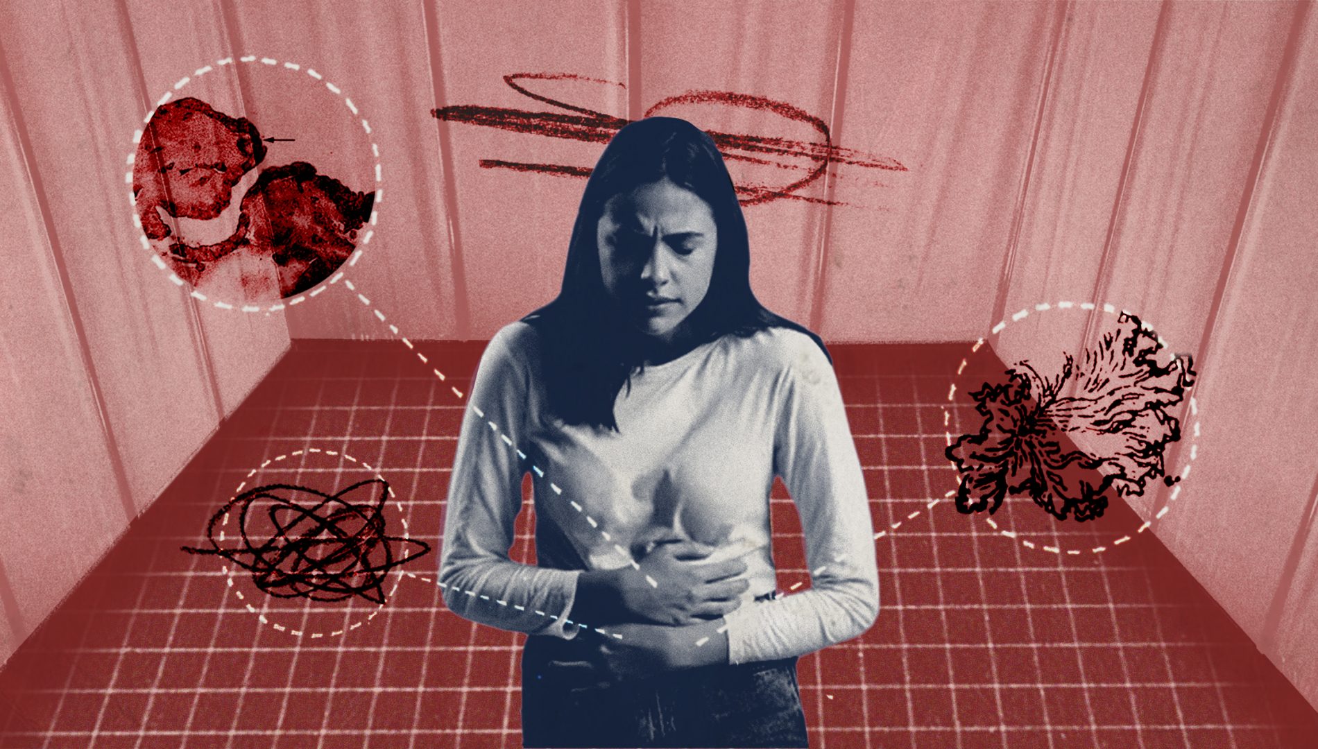 I was in so much pain I'd faint — yet doctors ignored me for decades